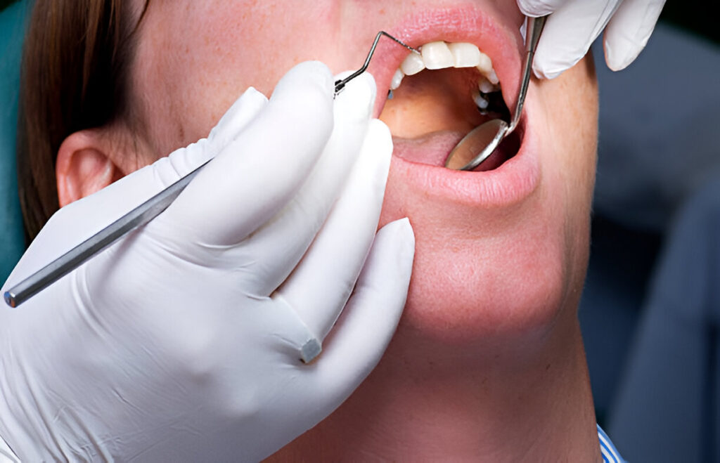 Restorative dentistry care in Edmonton by Mainstreet Dental Clinic