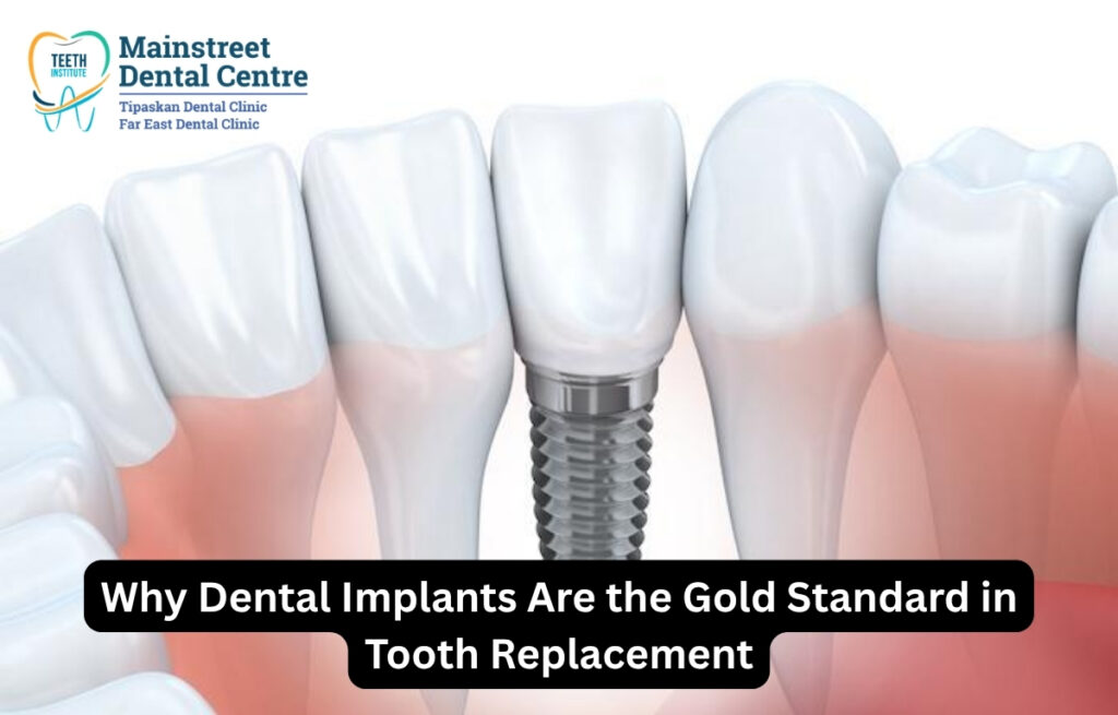 Dental implants Edmonton permanent tooth replacement solution